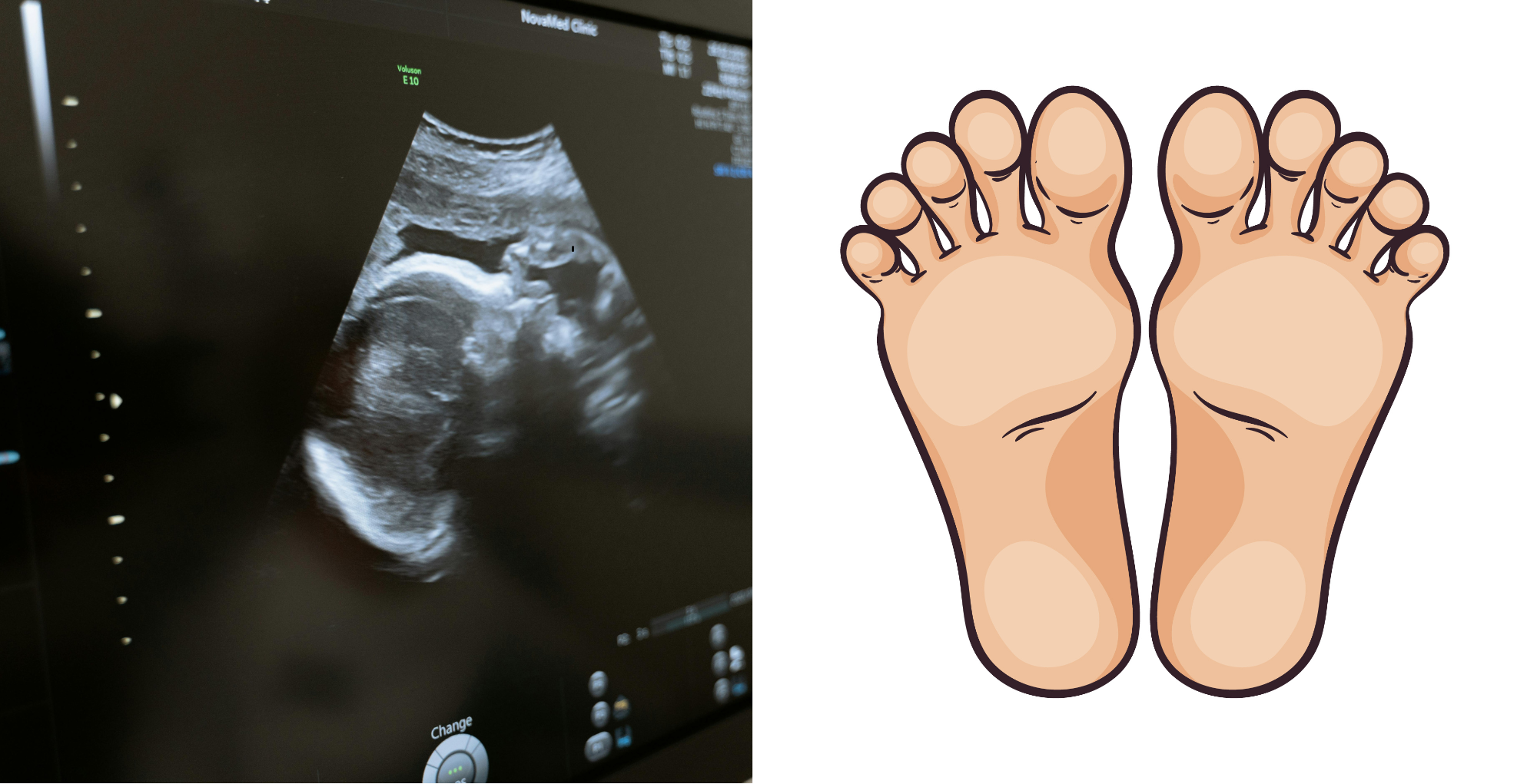 Why Your Organization May Need an Ultrasound