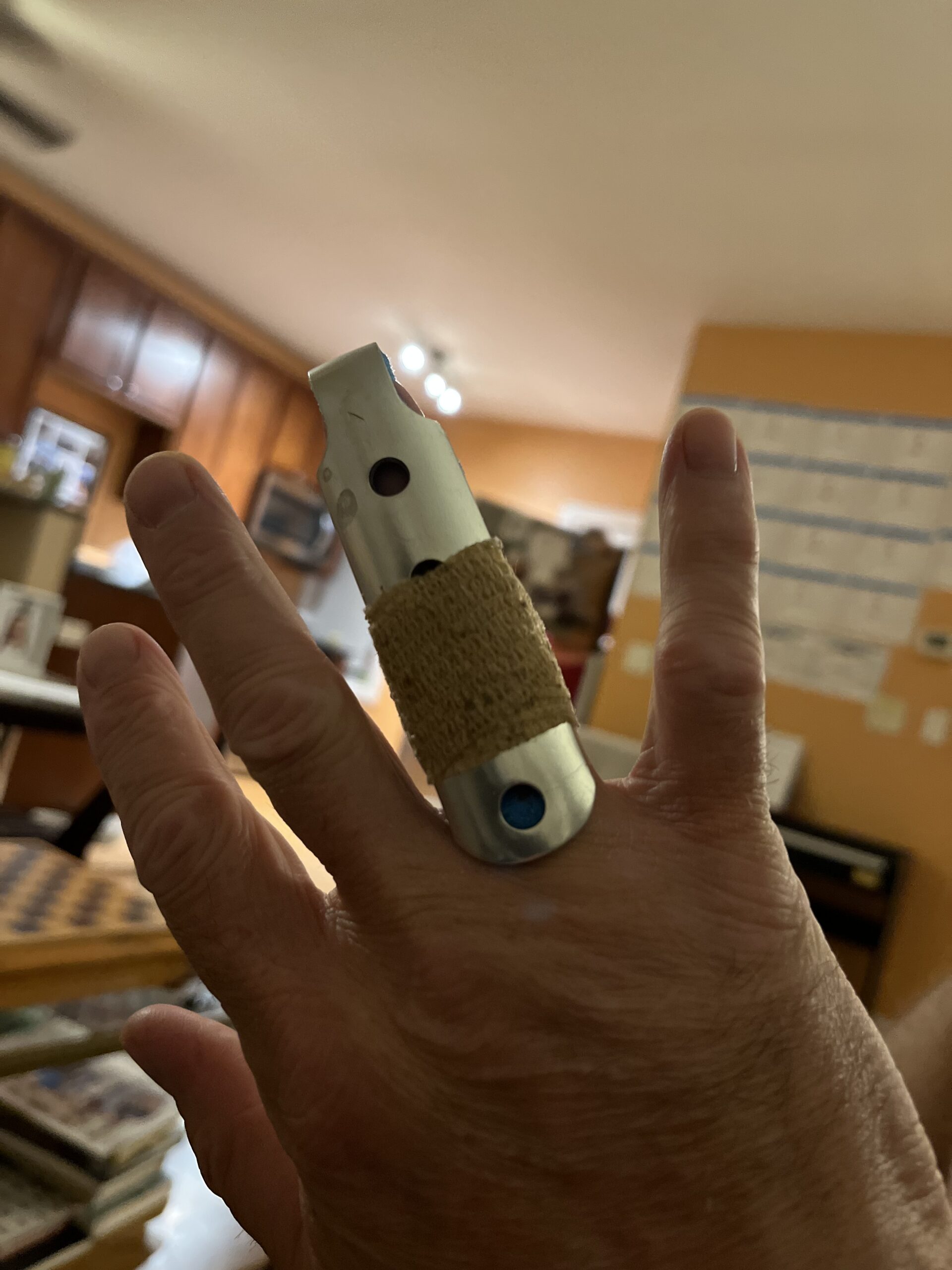 My dog broke my finger